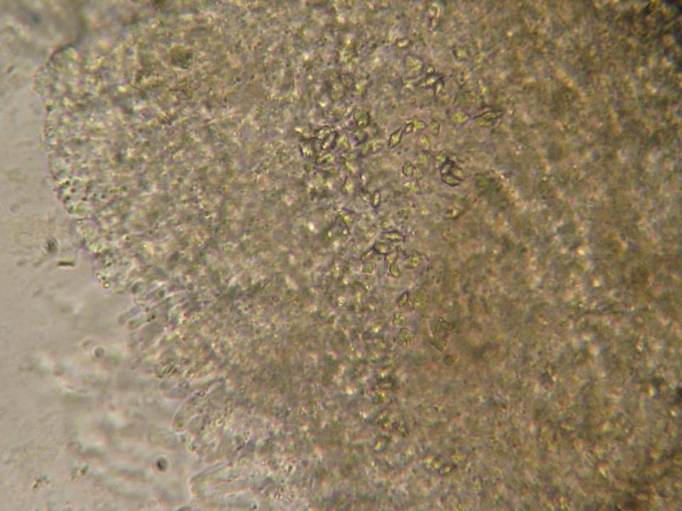 Phlebia livida image