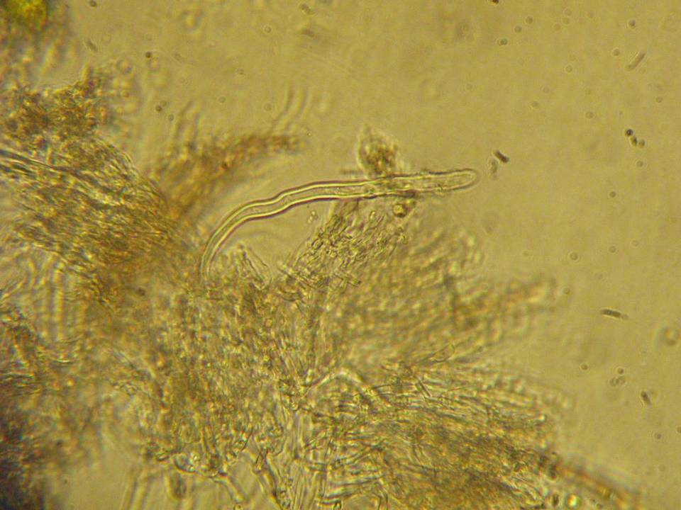 Hyphodontia cineracea image