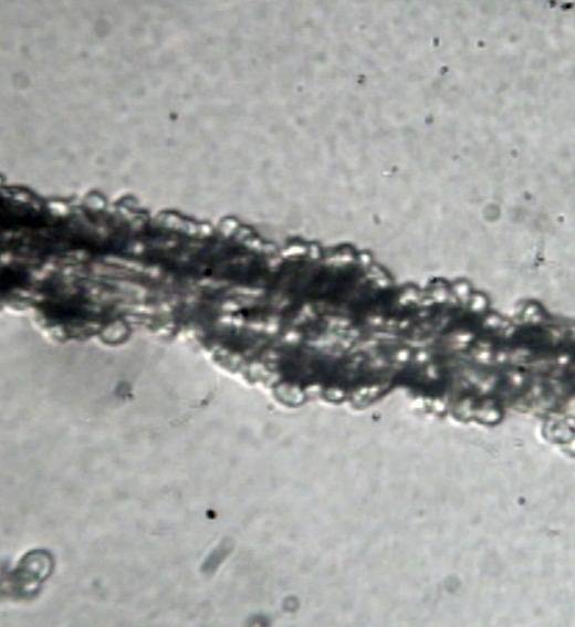Graphiola phoenicis image