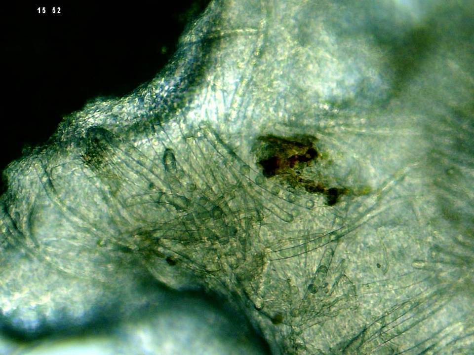 Pseudoplectania melaena image