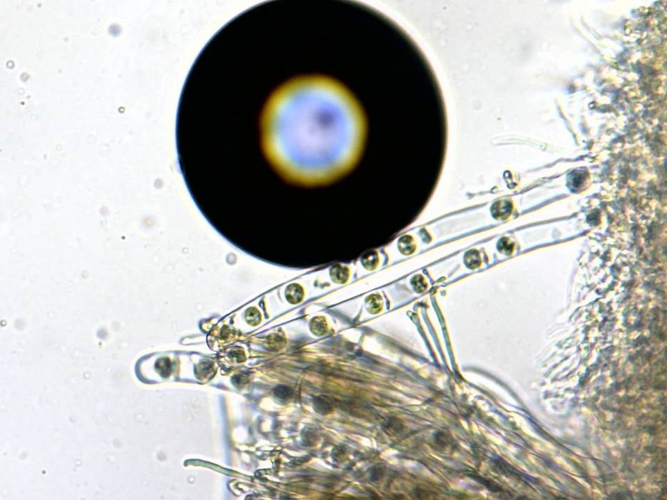 Pseudoplectania melaena image