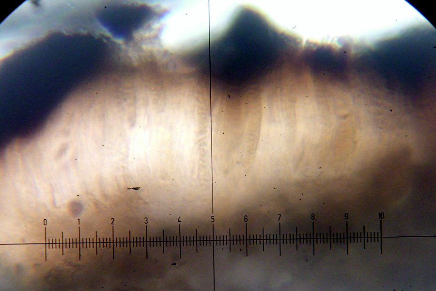 Polysporina cyclocarpa image