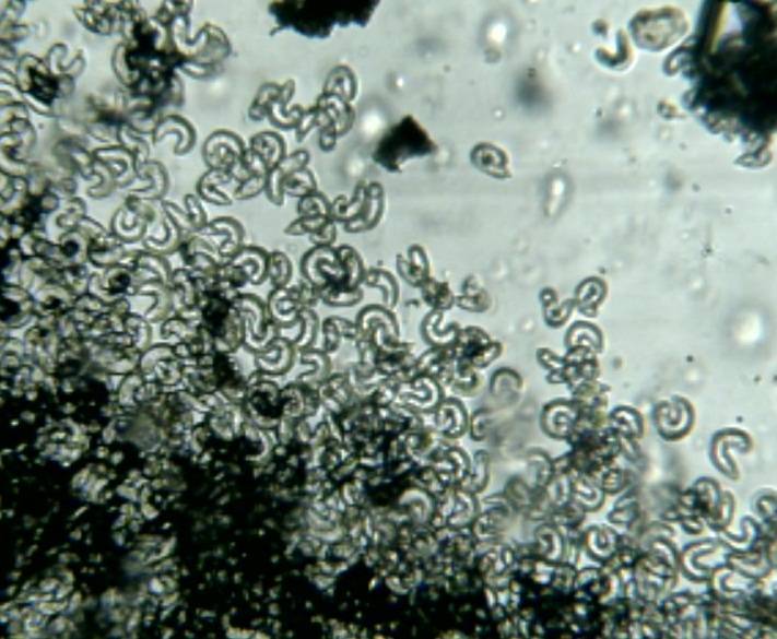 Drepanoconis image