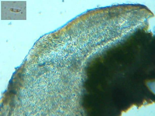 Protoparmelia badia image