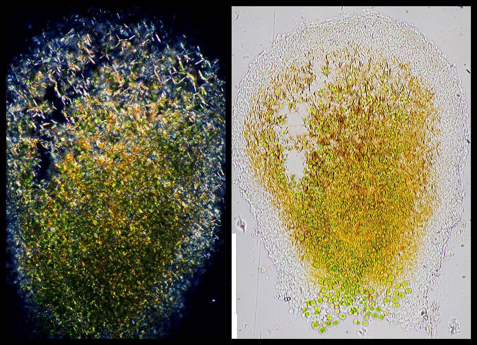 Pertusaria coccodes image