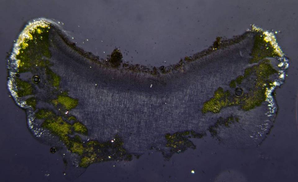 Lecanora straminea image