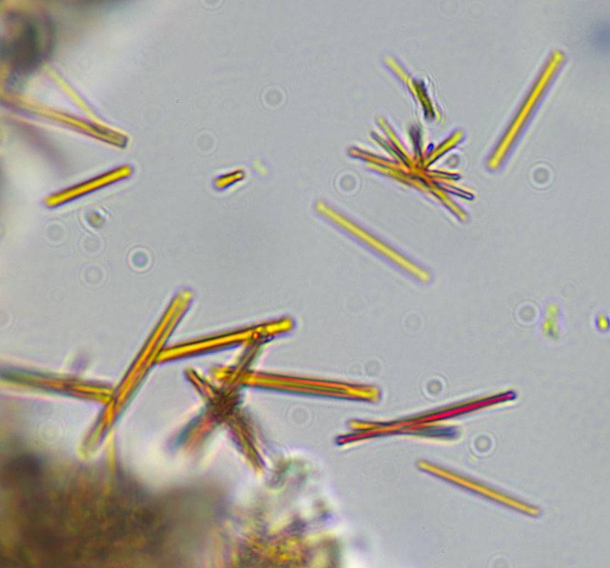 Diplotomma chlorophaeum image