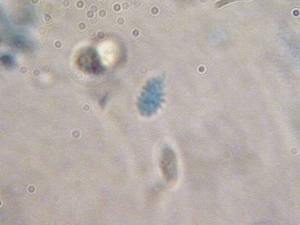 Xenasma tulasnelloideum image