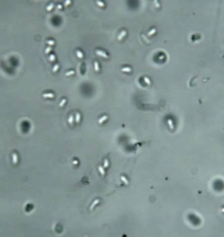 Poronia pileiformis image
