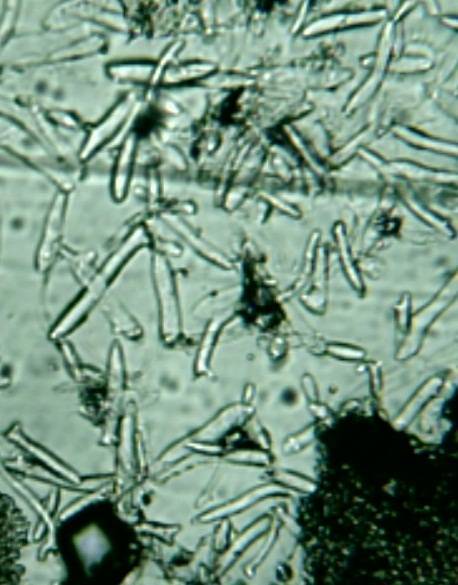 Cystolepiota petasiformis image