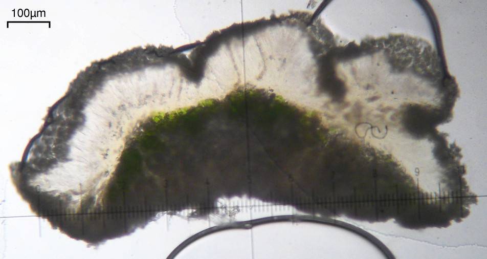 Lichenodiplis lecanorae image