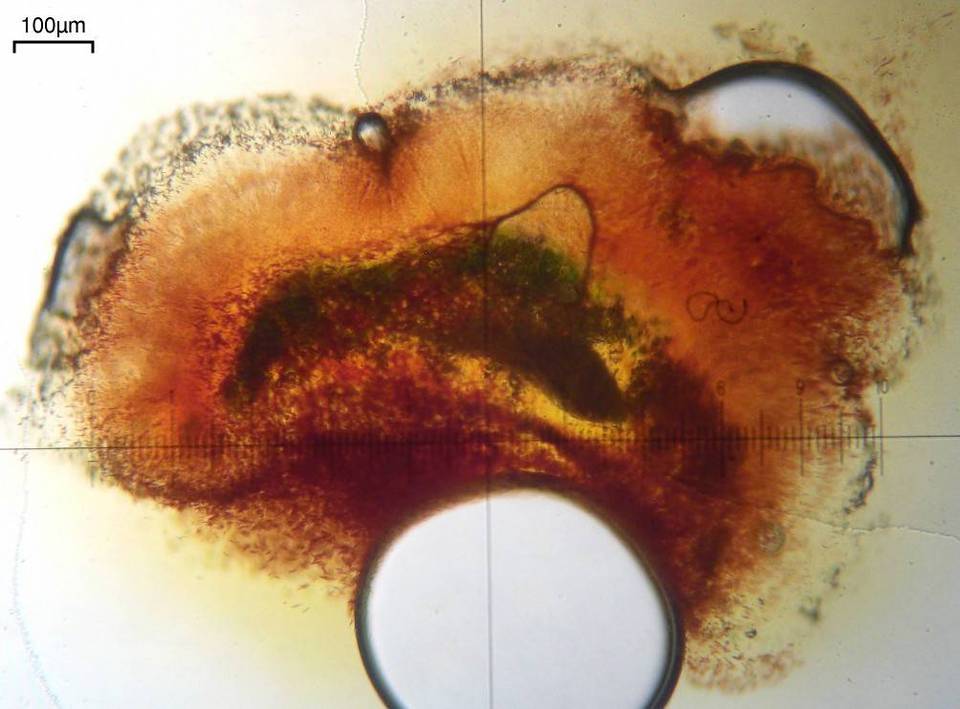 Lichenodiplis lecanorae image