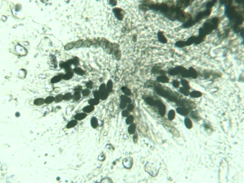 Poronia pileiformis image