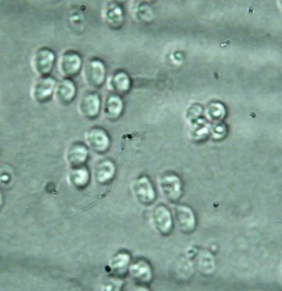 Limacella subillinita image