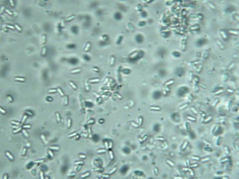 Laternea triscapa image