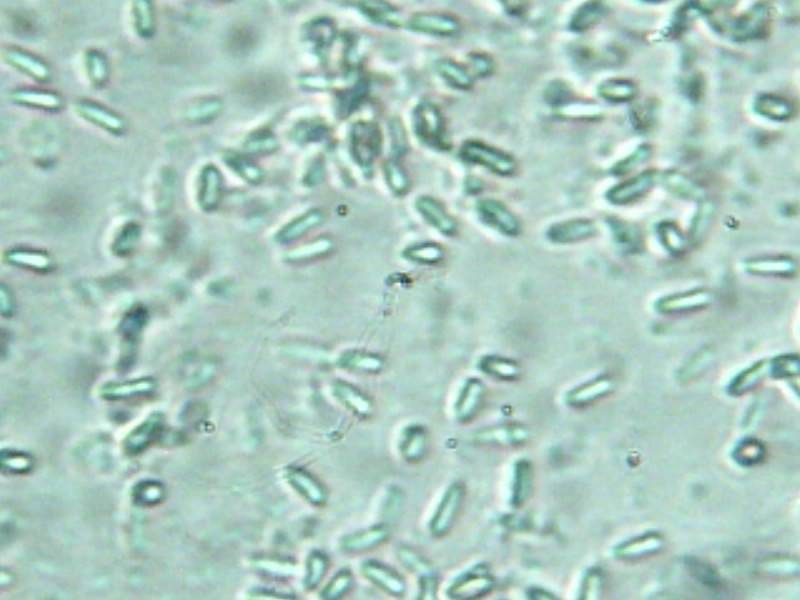 Laternea triscapa image