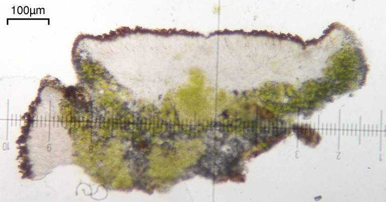Caloplaca atroflava image