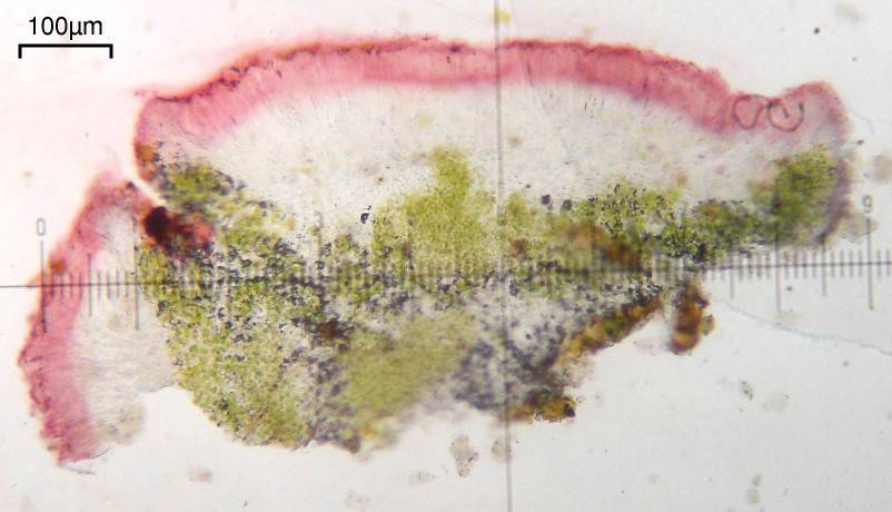 Caloplaca atroflava image