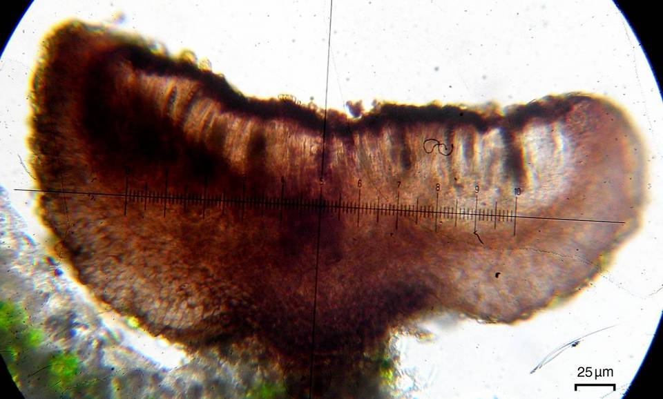 Dactylospora parasitica image