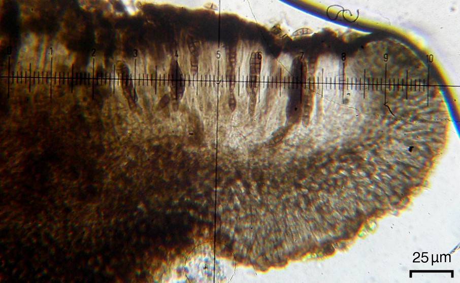 Dactylospora parasitica image