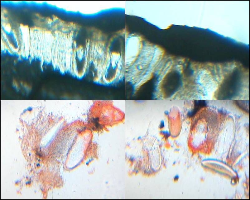 Pertusaria melanochlora image