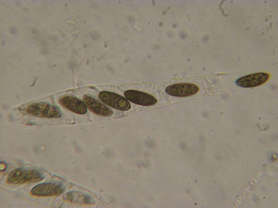 Rosellinia diathrausta image