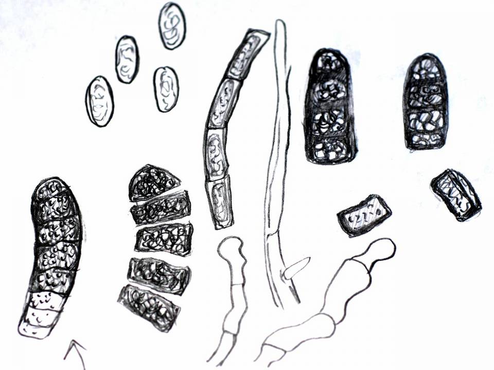 Thielaviopsis basicola image