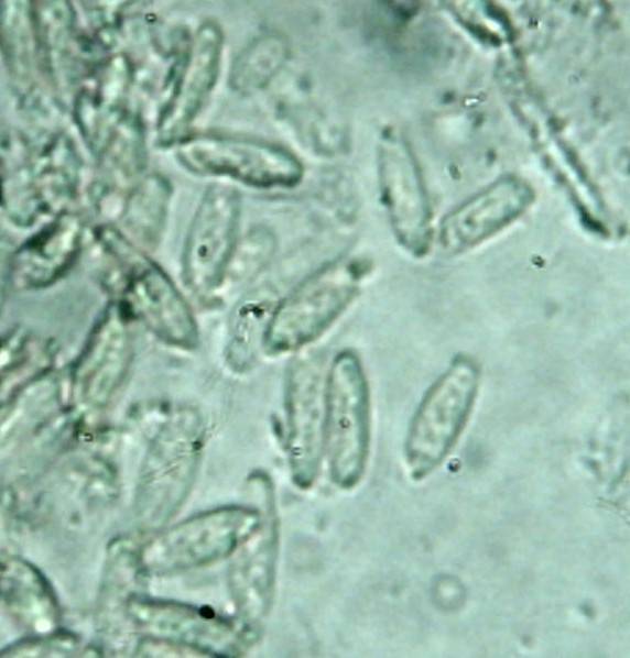 Echinoporia aculeifera image
