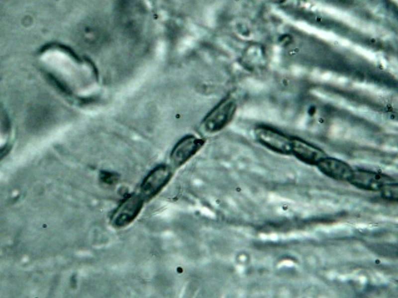Xylaria scopiformis image
