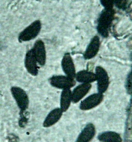 Hypoxylon lenormandii image