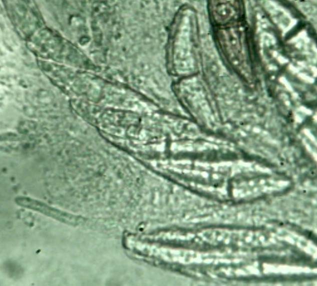 Calostilbe striispora image