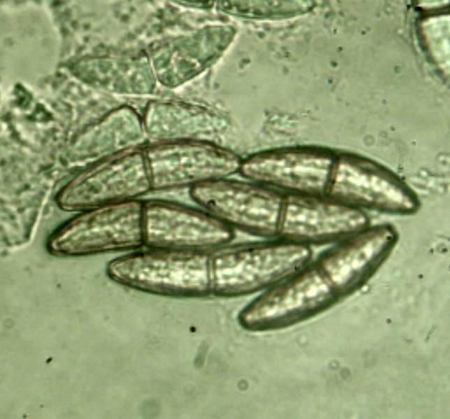 Calostilbe striispora image
