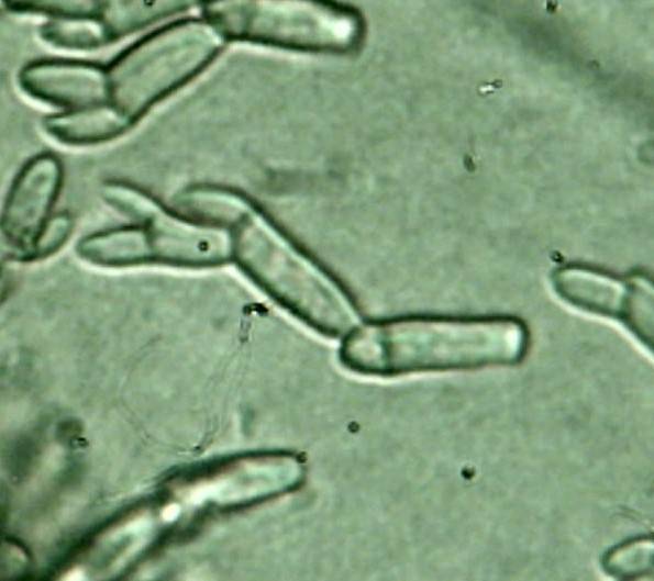 Annellodochium ramulisporum image