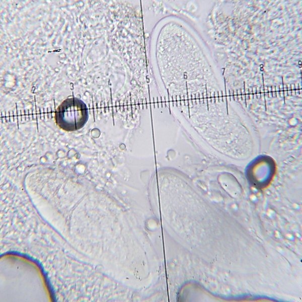 Pertusaria multipunctoides image