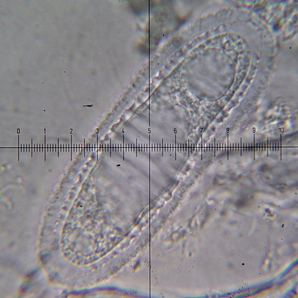 Pertusaria xanthodes image