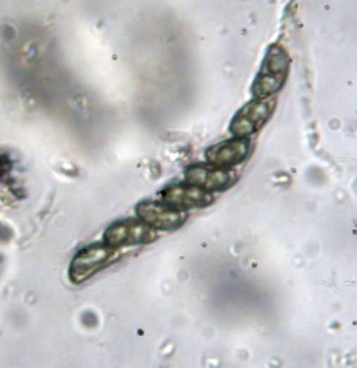 Kretzschmariella image