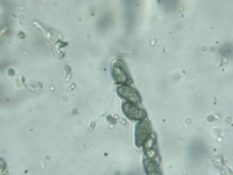 Kretzschmariella image