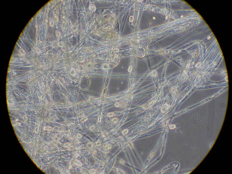 Mucor racemosus f. racemosus image