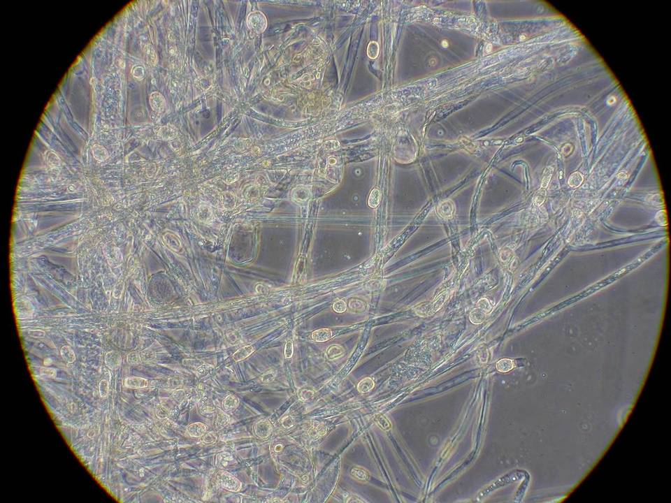 Mucor racemosus f. racemosus image