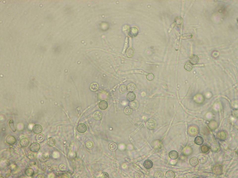 Humicola lanuginosa image