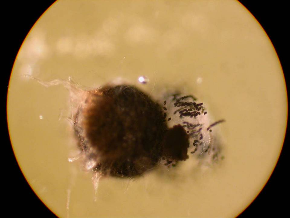 Neurospora image
