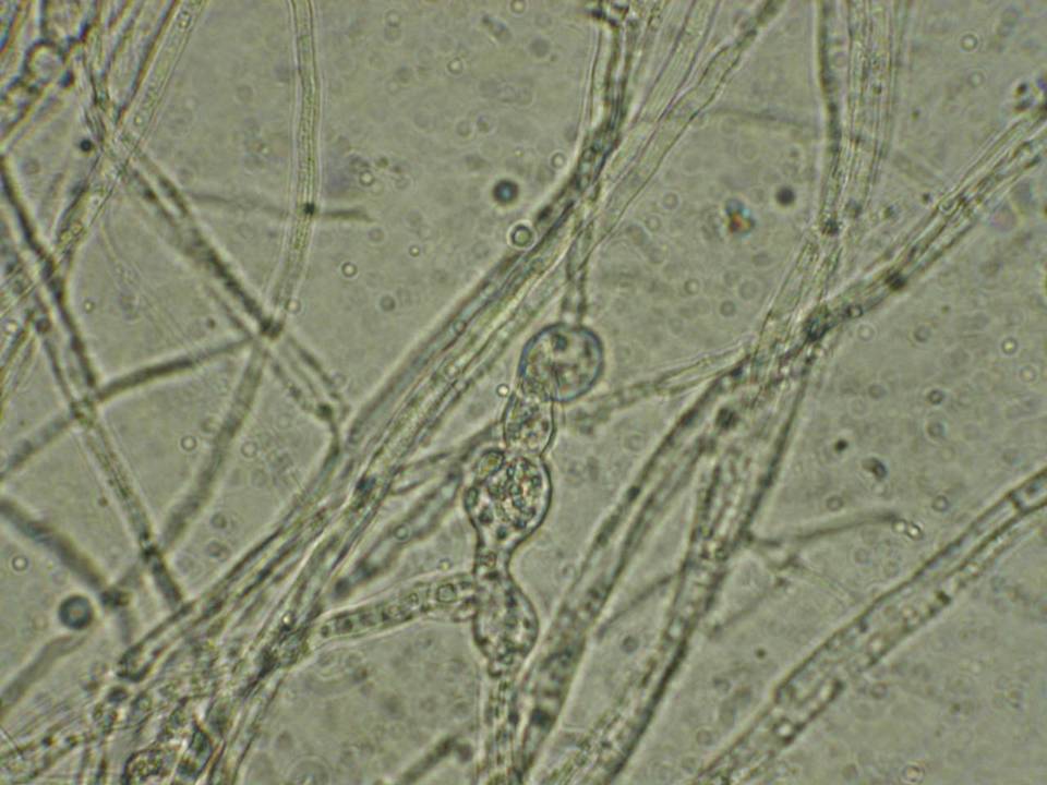 Fusarium equiseti image