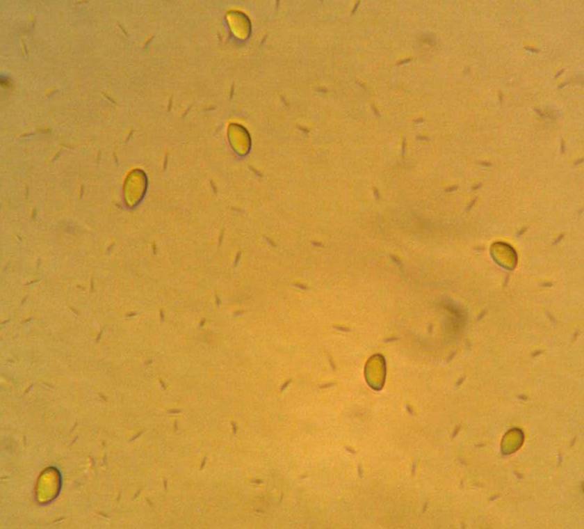 Atheniella leptophylla image