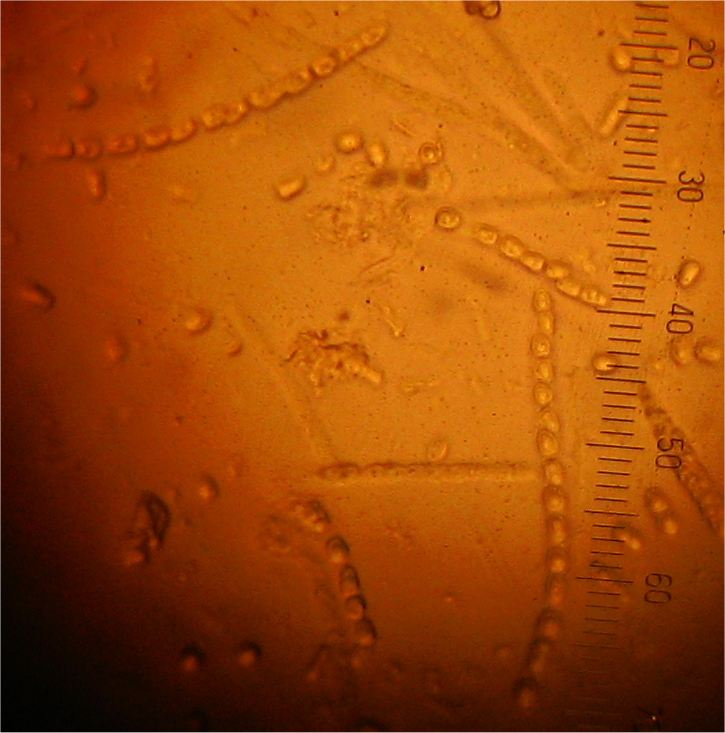 Hypocrea nybergiana image
