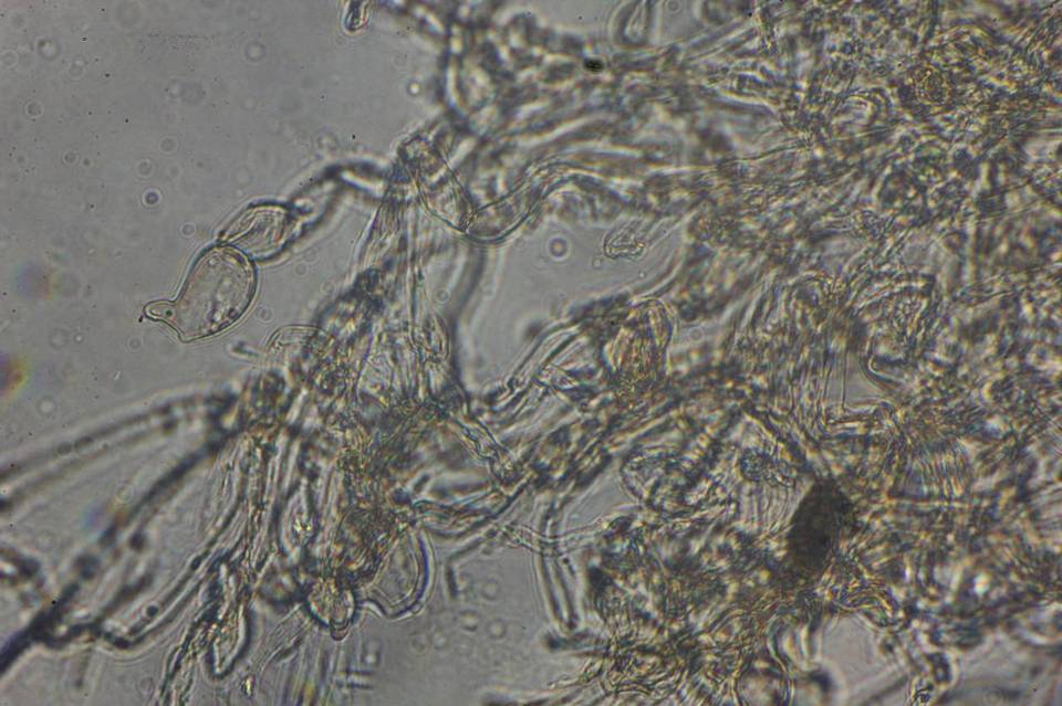 Echinoderma carinii image