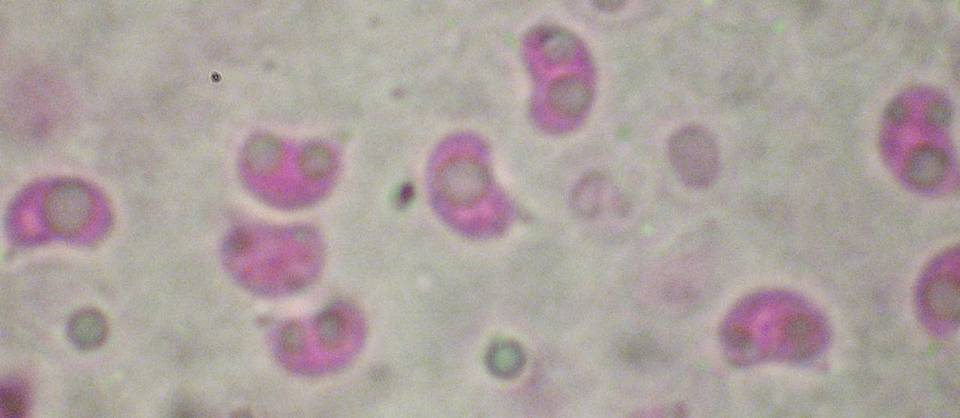 Gloeodontia subasperispora image