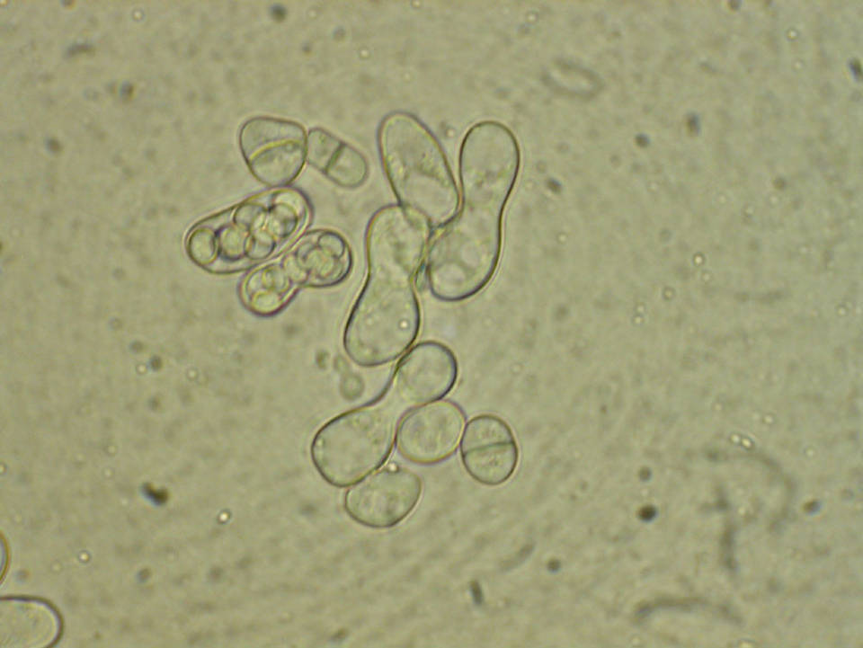 Schizosaccharomyces octosporus image