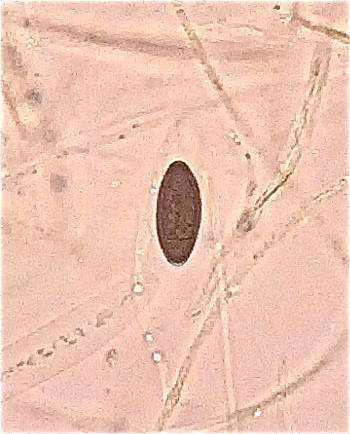 Neohypodiscus cerebrinus image
