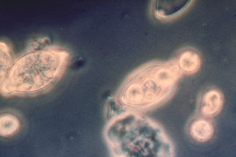Phytophthora infestans image