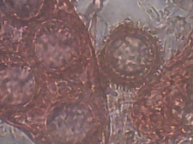 Genabea cerebriformis image